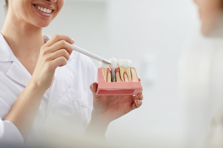 dental professional demonstrates a model of a tooth implant