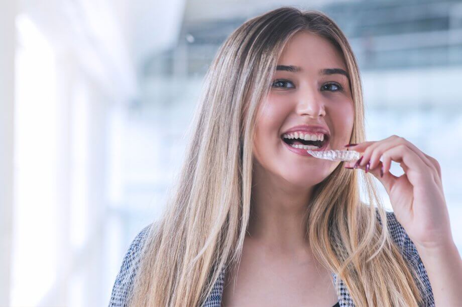 How Does Invisalign Work? | 508dentist
